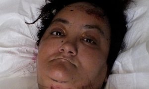 Polisievroue in ernstige ongeluk